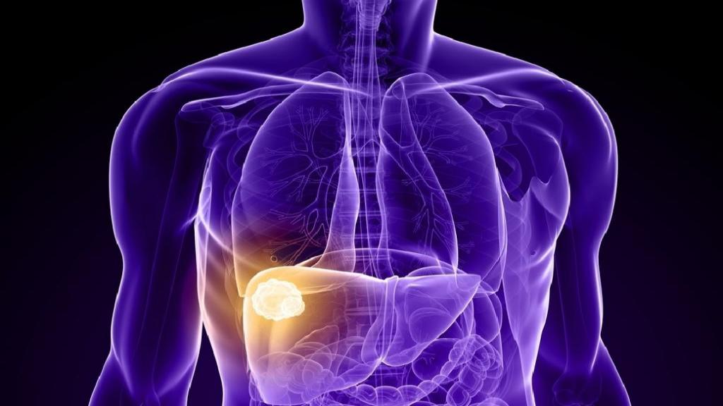 liver-cancer